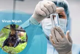 Bộ Y tế ban hành hướng dẫn chẩn đoán và điều trị bệnh do virus Nipah