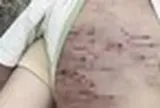 Liên tiếp các vụ bạo hành trẻ em, Bộ Y tế vào cuộc