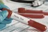 TPHCM tăng cường giám sát cửa khẩu, chủ động phòng nguy cơ dịch bệnh Ebola xâm nhập