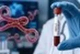 Bộ Y tế kích hoạt giám sát dich Ebola, tăng cường ngăn dịch xâm nhập