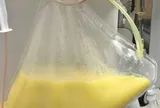 Người đàn ông 32 tuổi máu "trắng đục như sữa" sau khi ăn món thịt quen thuộc