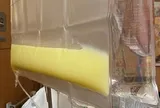 Người đàn ông 36 tuổi "máu trắng đục như mỡ lợn" vì thường xuyên ăn món ai cũng thích