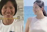 Ánh Viên trước và sau khi niềng răng