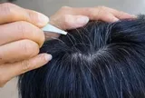 Lời khuyên cho những ai có tóc bạc sớm