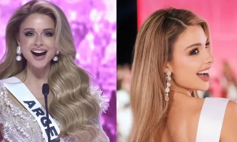 Đối thủ của Hương Giang tại Miss Universe: Xinh đẹp như búp bê sống đúng nghĩa