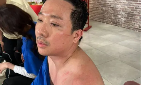 Trấn Thành tiếp tục phải trả giá