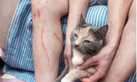 Bị mèo cào, người đàn ông 71 tuổi tử vong trong đau đớn