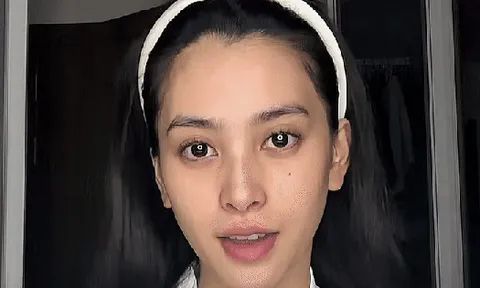 Mặt mộc của Tiểu Vy đẹp hơn cả khi trang điểm, duy nhất 1 khuyết điểm như người thường