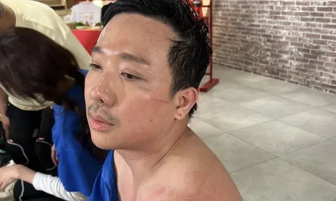 Sao Trấn Thành đến nông nỗi này?