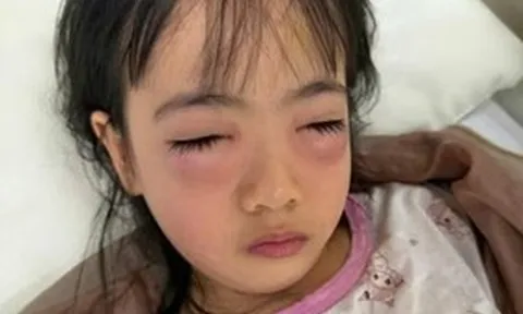 Chơi bong bóng xà phòng, bé 5 tuổi nguy kịch phải cấp cứu, sự thật khiến mẹ "sốc nặng"