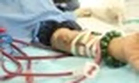 Bệnh viện Bạch Mai cảnh báo: Suy thận đang trẻ hóa, nhiều người tuổi 20 phải lọc máu