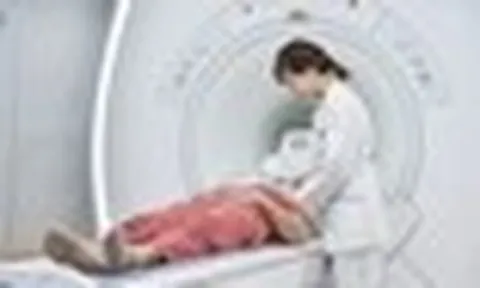 Người phụ nữ 44 tuổi đi khám đau đầu, bác sĩ bất ngờ khi nhìn kết quả chụp não