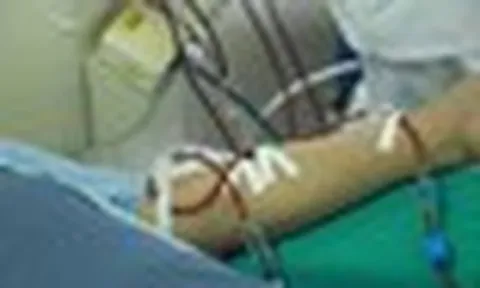 Có dấu hiệu này cần nghĩ tới suy thận - bác sĩ cảnh báo