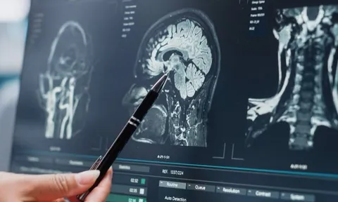 Cú đập bóng chày vào đầu biến cậu bé thành hiện tượng thiên tài khiến giới khoa học kinh ngạc