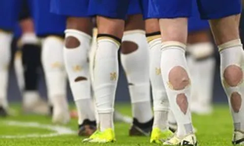 Phát hiện nhiều cầu thủ World Cup đi tất rách ra sân