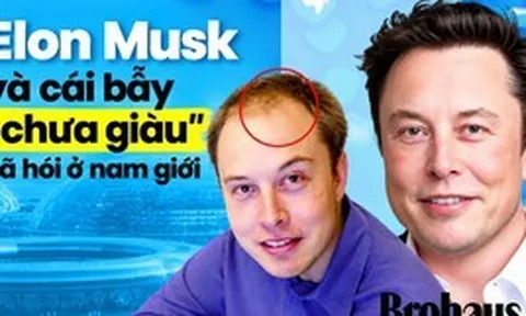 Chưa kịp giàu đã hói: Nghi vấn từ mái tóc hồi sinh của Elon Musk và cái bẫy "cày cuốc" bóp nghẹt phong độ đàn ông
