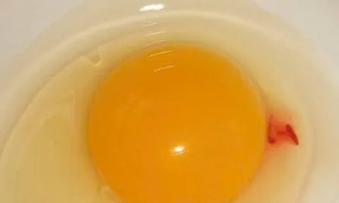 Vì sao lòng đỏ trứng lại có đốm máu? Câu trả lời khiến nhiều người bất ngờ