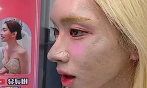 Hơn 2 triệu người hoảng hốt với bức ảnh như cả "tấn phấn" trên mặt của idol live Hàn Quốc