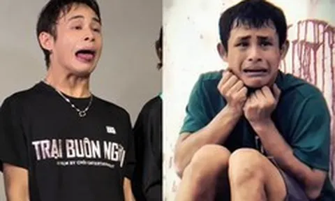 Chàng trai mắc hội chứng lạ gây sốt trong phim 'Trại buôn người'