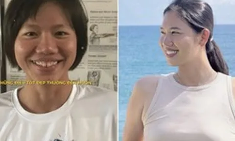 Ánh Viên trước và sau khi niềng răng