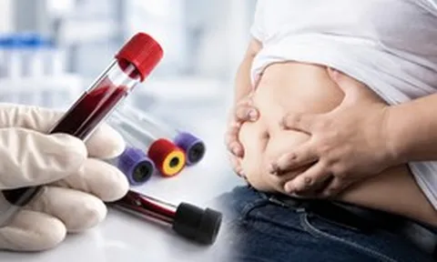 2 thực phẩm này làm tăng lượng mỡ trong máu mạnh hơn cả thịt chiên rán, nhiều người ăn chúng mỗi ngày mà không hề nhận ra