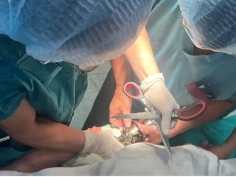 Bé trai 5 tuổi "ôm" ổ khóa nhập viện cấp cứu, bác sĩ phát cảnh báo khẩn