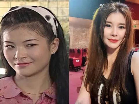 Nữ NSƯT từng đóng vợ anh Núi: U50 chi 1 tỉ đồng sang Hàn đại phẫu nhan sắc, chọn sống độc thân