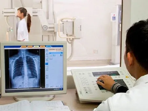 Bộ Y tế: Không lấy thời gian chụp X-quang 6 phút làm căn cứ từ chối thanh toán BHYT