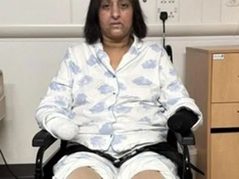 Bị chó cưng liếm, người phụ nữ "sốc" khi phải cắt cụt tay chân