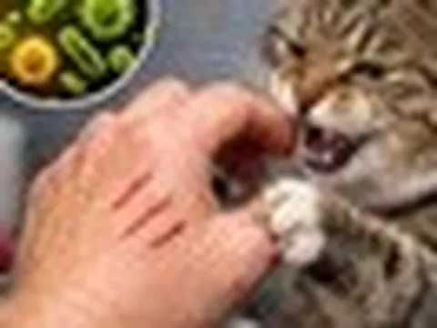 Cháu bé 5 tuổi tử vong sau 4 tháng bị mèo cào vào tay và chó cắn trượt da