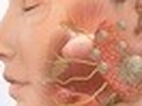 Có 1 dấu hiệu bất thường ở mặt, đi khám phát hiện hàng loạt vấn đề ở phổi, gan, thận, dạ dày