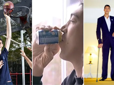 Bí ẩn căn bệnh khiến người đàn ông biến thành gã khổng lồ