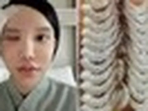 Người phụ nữ bị ký sinh trùng bò vào hốc mắt, suýt mù, bác sĩ cảnh báo 1 thói quen nhiều người Việt mắc phải