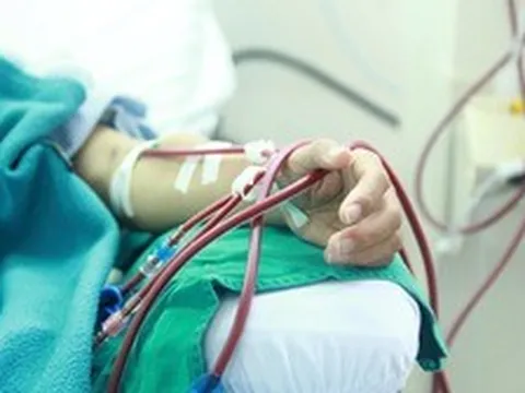 Đừng để tuổi 20 đã phải chạy thận: Bác sĩ Bạch Mai cảnh báo dấu hiệu nhiều người trẻ bỏ qua
