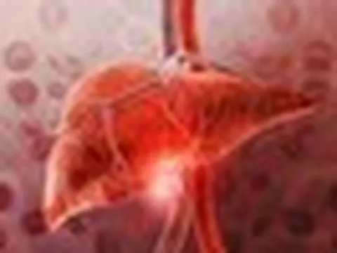 1 thói quen giải khát "bức tử" lá gan: Nhiều người Việt đang làm mỗi ngày