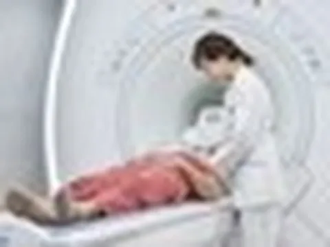 Người phụ nữ 44 tuổi đi khám đau đầu, bác sĩ bất ngờ khi nhìn kết quả chụp não