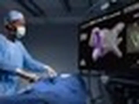 Lần đầu tiên tại Việt Nam: Làm chủ công nghệ "xóa sổ" nỗi lo đột quỵ