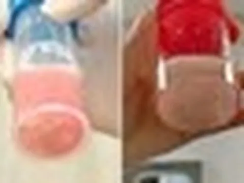 Cô bé 12 tuổi phổi trắng xóa và đông đặc sau 1 ngày bị sốt, bác sĩ cảnh báo: Đừng lúc nào cũng tưởng con cảm lạnh!