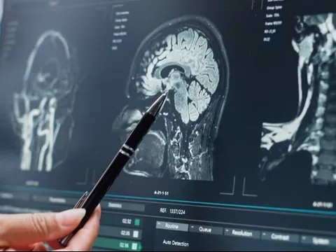 Cú đập bóng chày vào đầu biến cậu bé thành hiện tượng thiên tài khiến giới khoa học kinh ngạc