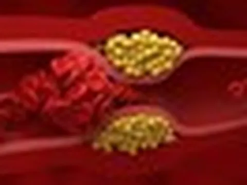 Không cần thực phẩm đắt tiền, bác sĩ chỉ 4 món quen thuộc giúp giảm cholesterol “cực đỉnh”