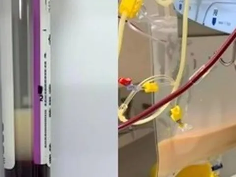 Người phụ nữ ngoài 30 tuổi máu trắng như sữa sau khi uống 4 cốc nước "vạn người mê" trong 1 ngày