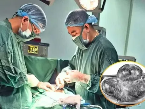 Bụng phình to bất thường, sự thật bác sĩ nói ra khiến người phụ nữ sốc nặng